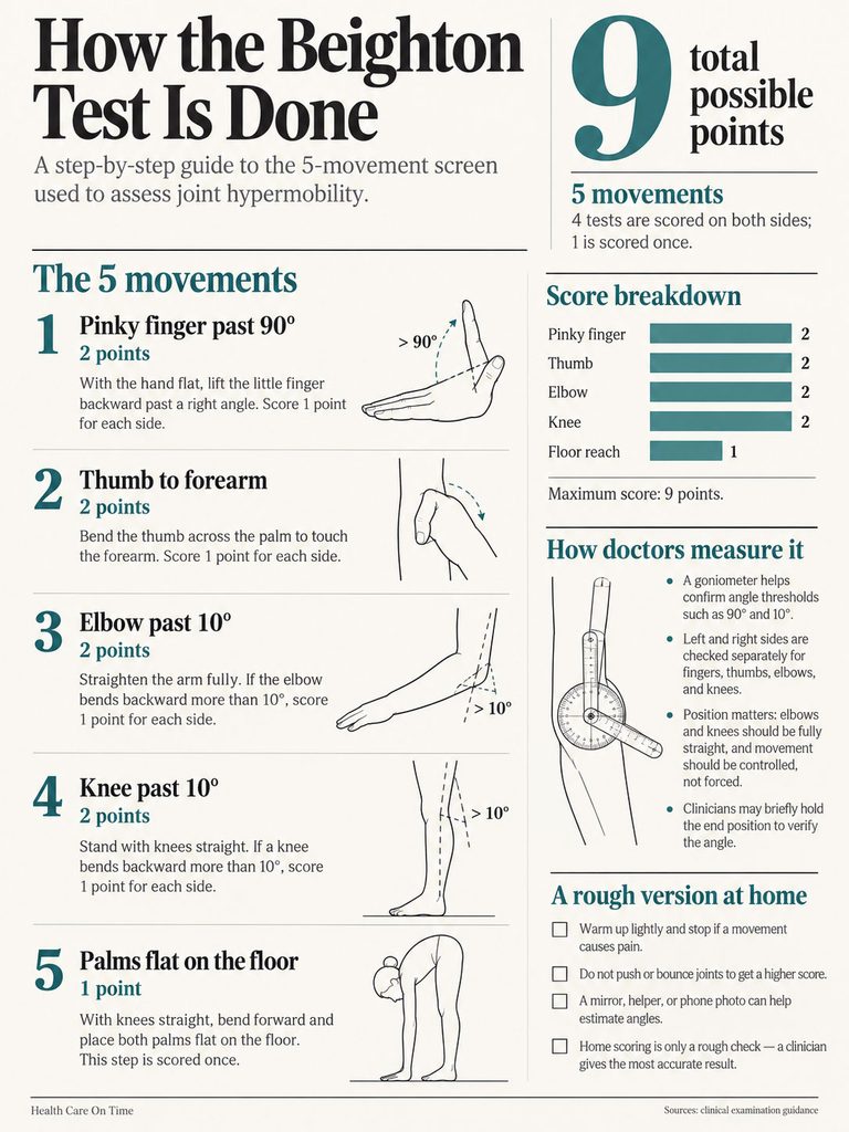 Infographic showing the Beighton Test steps to assess joint hypermobility with illustrations and scoring details.